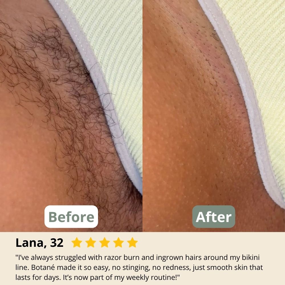 Botane Labs Woman - Hair Removal Cream